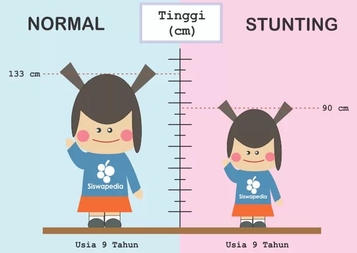 Permasalahan Stunting di Riau Jadi Halangan Wujudkan SDM Berkualitas