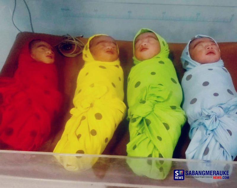 Begini Kondisi Bayi Kembar 4 Laki-laki yang Dipantau Intensif di Ruang Perina RSIA Milano Teluk Kuantan