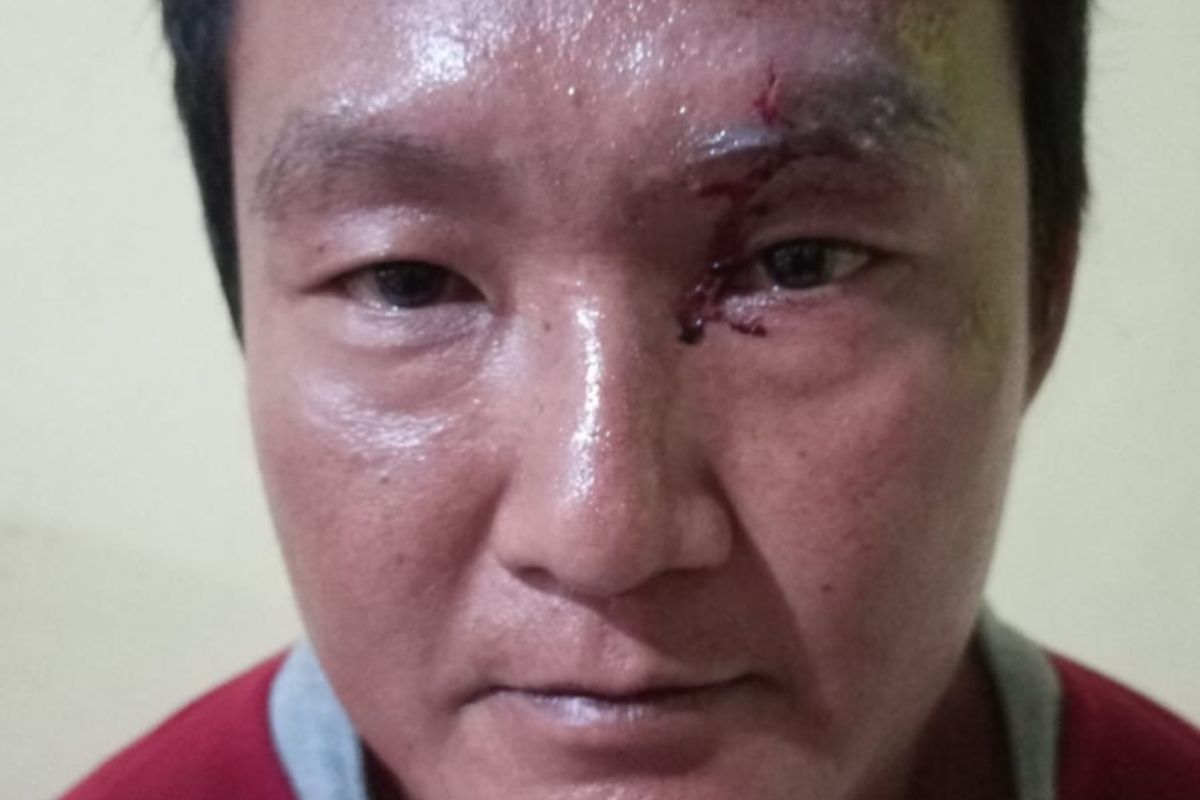 Anggota DPRD Kampar Toni Hidayat Disiram Air Cabai Saat Syukuran Bersama Warga