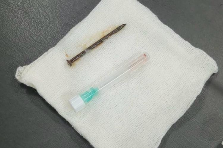 Waduh! Paru-paru Pria di Riau Ini Kemasukan Paku
