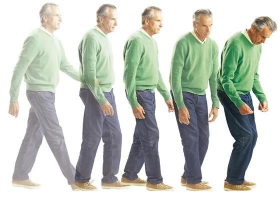 Bukan Sekadar Tremor, Parkinson Diam-Diam Hancurkan Hidup, Ini Penjelasan Lengkapnya