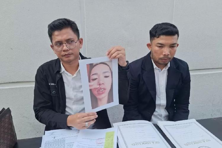 Wow! Mantan Finalis Puteri Indonesia Riau 2024 Ditahan Polisi, Diduga Jadi Dokter Kecantikan Gadungan