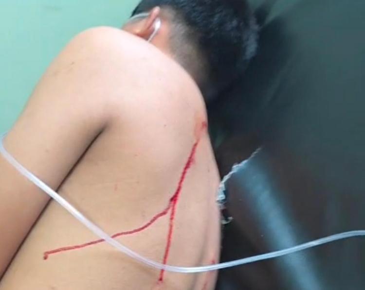 Penyerangan di PT Sinar Belilas Perkasa di Inhu, 6 Karyawan Menderita Luka Tembak dan Bacok
