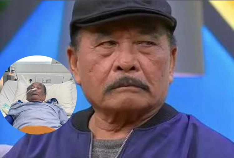 Komedian Senior Bolot Alami Serangan Jantung, Dokter Ungkap Tanda Nyeri Dada Berbahaya yang Sering Disepelekan