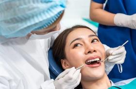 Kabar Gembira! Scaling Gigi Ditanggung BPJS Kesehatan, Ini Syarat dan Cara Mendapatkannya